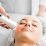 Photofacial Treatment for skin imperfections