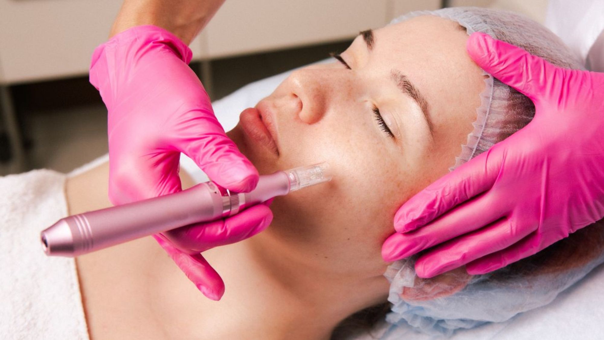 The Surprising Benefits of the Salmon Sperm Facial: Why This Trend Is